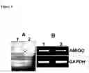Fig. 02 - Transmembrane protein amigo and uses thereof
