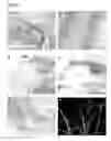 Fig. 08 - Transmembrane protein amigo and uses thereof