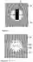 Fig. 06 - Arrangement and method with thermal field for nuclear storage