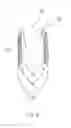 Fig. 07 - In vivo device for improving diastolic ventricular function