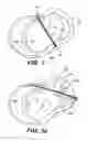Fig. 02 - Methods and devices for improving mitral valve function
