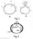 Fig. 04 - Anatomic device