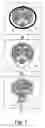 Fig. 06 - Anatomic device
