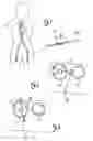 Fig. 02 - Optically guided penetration catheters and their methods of use