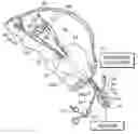 Fig. 02 - Intra-abdominal surgical method and associated apparatus