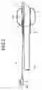 Fig. 03 - Endoscope-equipped puncture balloon