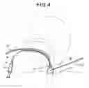 Fig. 05 - Endoscope-equipped puncture balloon