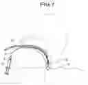 Fig. 08 - Endoscope-equipped puncture balloon