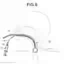 Fig. 09 - Endoscope-equipped puncture balloon