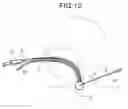 Fig. 13 - Endoscope-equipped puncture balloon