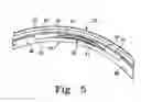 Fig. 06 - Instruments and methods for selective tissue retraction through a retractor sleeve