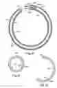 Fig. 06 - Electrophysiology loop catheter