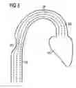 Fig. 04 - Method for representation of flow in a magnetic resonance image
