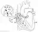 Fig. 01 - Reference catheter for impedance calibration