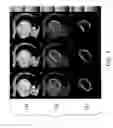 Fig. 08 - X-ray CT apparatus and myocardial perfusion image generating system