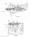 Fig. 03 - Anatomically-referenced fiducial marker for registration of data