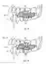 Fig. 05 - Anatomically-referenced fiducial marker for registration of data