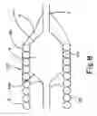 Fig. 09 - Guide wire