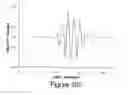 Fig. 24 - Finite amplitude distortion-based inhomogeneous pulse echo ultrasonic imaging