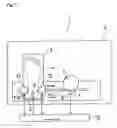 Fig. 02 - Ultrasonic bone evaluation apparatus