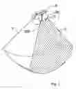 Fig. 02 - Ultrasonic imaging method and probe for 3D gynaecologic inspection