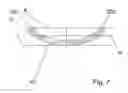 Fig. 08 - Ultrasonic imaging method and probe for 3D gynaecologic inspection