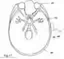 Fig. 15 - Automatic signal-optimizing transducer assembly for blood flow measurement