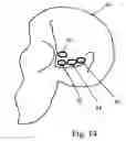 Fig. 17 - Automatic signal-optimizing transducer assembly for blood flow measurement