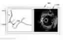 Fig. 01 - Vascular image co-registration