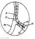 Fig. 01 - Systems and methods for estimating the length and position of a stent to be applied within a patient