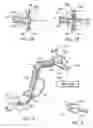 Fig. 03 - Endoscopic medical method and associated device