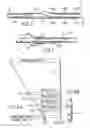 Fig. 03 - Ultrasonic imaging catheters