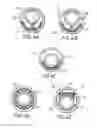 Fig. 04 - Ultrasonic imaging catheters