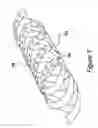 Fig. 05 - Ultrasonic imaging catheters