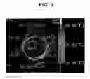 Fig. 07 - Ultrasonic imaging system and imaging method