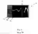 Fig. 03 - Method and apparatus of signal processing for use in spectrometry using an improved apodization function