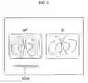 Fig. 06 - Image data processor, computer program product, and electronic endoscope system