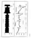 Fig. 02 - Method and apparatus for diagnosing respiratory disorders and determining the degree of exacerbations