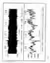 Fig. 03 - Method and apparatus for diagnosing respiratory disorders and determining the degree of exacerbations