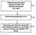Fig. 01 - Computerized method for predicting the diastolic rest period in a cardiac cycle