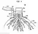 Fig. 05 - Method and system for detecting electrophysiological changes in pre-cancerous and cancerous tissue and epithelium
