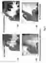Fig. 04 - System and method for inducing controlled cardiac damage