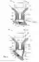 Fig. 05 - Apparatus and method for treatment of damaged tissue