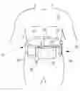 Fig. 01 - METHOD FOR INSTALLING AND SERVICING A WEARABLE CONTINUOUS RENAL REPLACEMENT THERAPY DEVICE