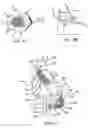 Fig. 02 - Methods and devices for improving cardiac output
