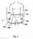 Fig. 04 - Apparatus and method for precise ozone/oxygen delivery applied to the treatment of dermatological conditions, including gas gangrene, and related disorders