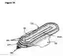 Fig. 07 - Automatic self cleaning bladder relief with battery pad system