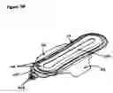 Fig. 08 - Automatic self cleaning bladder relief with battery pad system