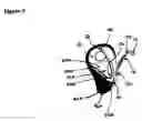 Fig. 10 - Automatic self cleaning bladder relief with battery pad system