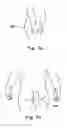 Fig. 08 - Absorbent article and method for maintaining or improving skin health